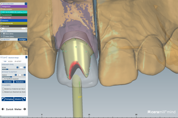 CadCam6