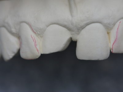Implantat1(1)