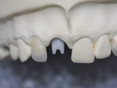 Implantat1(2)