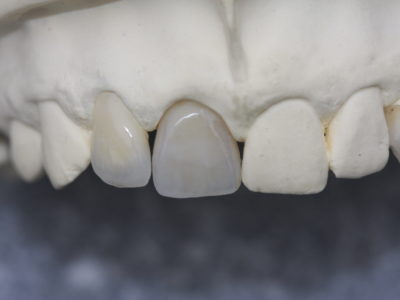 Implantat1(3)