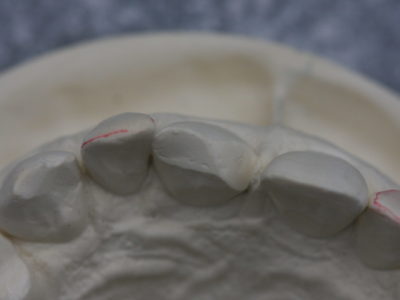 Implantat1(4)