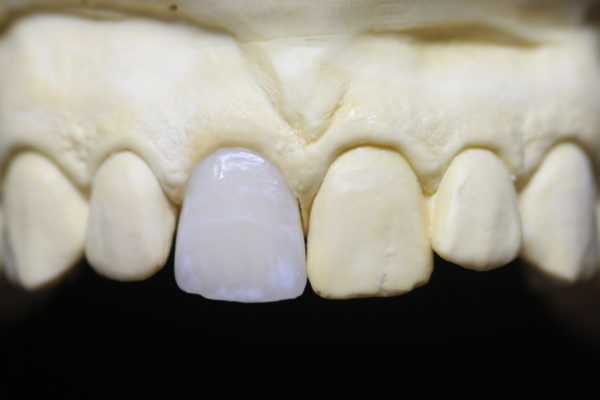 Implantat2(2)