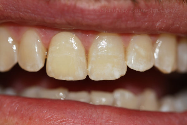 Implantat2(3)